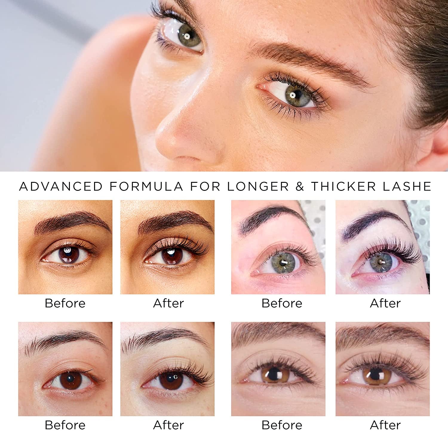 Eyelash and Brow Growth Serum, Irritation Free Formula, Guaranteed Results in 3-4 Weeks for Longer, Thicker, and Fuller Eyelashes